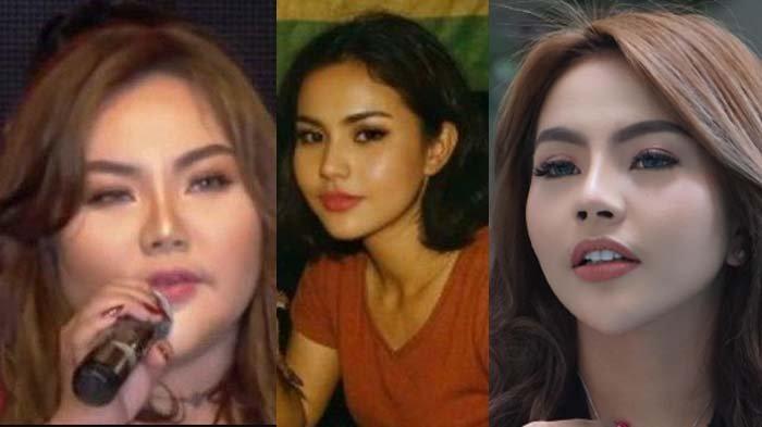 TAMPILAN LISA MARIANA - Berikut perubahan tampilan Lisa Mariana dari sebelum kena Ridwan Kamil hingga heboh mengaku hamil hingga punya anak dari RK. Video lawasnya beredar soal pengakuan oplas berkli kali.