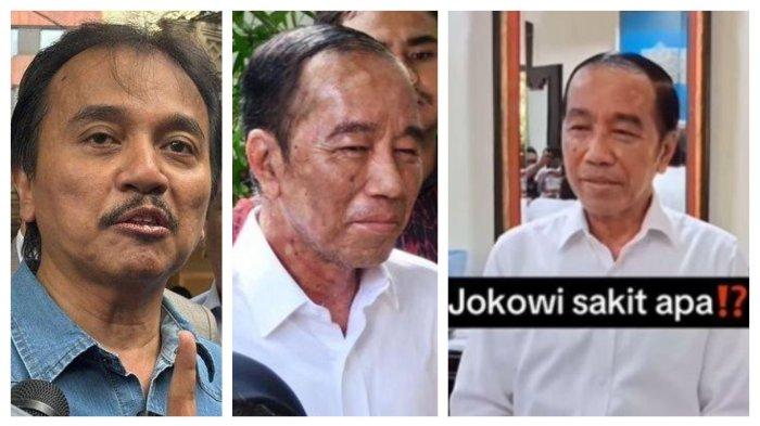 PENYAKIT JOKOWI - Mantan Menteri Pemuda dan Olahraga (Menpora) Roy Suryo memberikan keterangan terkait pemeriksaan atas kasus tudingan ijazah palsu Presiden ke-7 RI Joko Widodo di Polda Metro Jaya di Jakarta Selatan, Kamis (15/5/2025). Kolase foto wajah Jokowi sekarang. Jokowi tetap sebut alergi kulit, Dokter Tifa sebut Autoimun Agresif, Rocky Gerung sebut sakit Jokowi disebabkan karena psikosomatik, gangguan kejiwaan yang tidak bisa diatasi tubuh. Roy Suryo curiga Jokowi stres.
