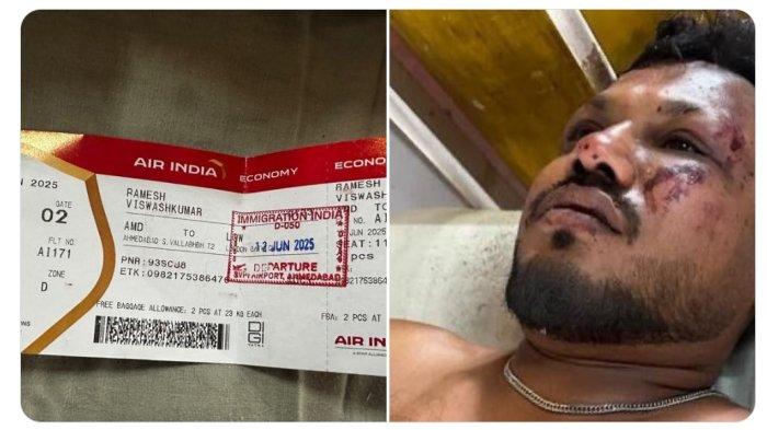 SATU PENUMPANG SELAMAT- Kecelakaan pesawat Air India di Ahmedabad secara ajaib menyisakan satu orang yang selamat. Korban selamat, yang sedang menjalani perawatan, telah diidentifikasi dia bernama Vishwas Kumar Ramesh, warga negara Inggris yang kembali ke London setelah kunjungan ke Gujarat.