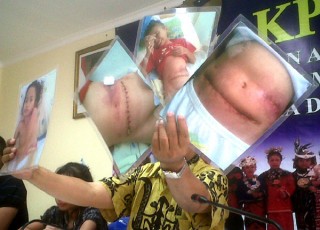 Elyana Fitri BAB Lewat Mulut - TribunNews.com