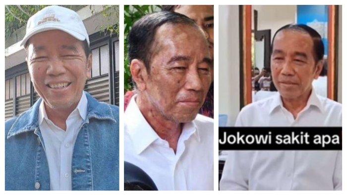 JOKO WIDODO - Presiden ke-7 Joko Widodo (Jokowi) mengungkapkan kondisi dirinya pasca mengalami alergi kulit saat ditemui di Jalan Kutai Utara, Kelurahan Sumber, Kecamatan Banjarsari, Kota Solo, Jawa Tengah (Jateng), pada Kamis (26/6/2025). Kolase foto wajah Jokowi sekarang. Jokowi tetap sebut alergi kulit, Dokter Tifa sebut Autoimun Agresif, Rocky Gerung sebut sakit Jokowi disebabkan karena psikosomatik, gangguan kejiwaan, Roy Suryo curiga Jokowi stres.