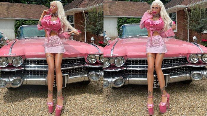 Alicia Almira, wanita asal Swedia yang menghabiskan hampir $127.280 untuk operasi plastik selama 10 tahun terakhir untuk menjadi seperti boneka Barbie di kehidupan nyata.