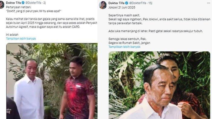 PERUBAHAN WAJAH JOKOWI: Tangkapan layar cuitan Dokter Tifa soal kondisi wajah Jokowi yang memprihatinkan, Minggu (22/6/2025). Kondisi terbaru wajah Jokowi di hari ulang tahunnya mengejutkan publik. Pasalnya wajah Jokowi disebut berbeda drastis dari sebelumnya saat menjabat.