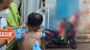 Di-Sukabumi-Ibu-dan-Anak-Disiram-Air-Keras-Orang-Tak-Dikenal-Luka-Bakar-Capai-20-Persen.jpg