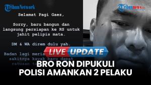Polisi Amankan Dua Terduga Pelaku Pemukulan terhadap Waketum PSI Ronald Sinaga