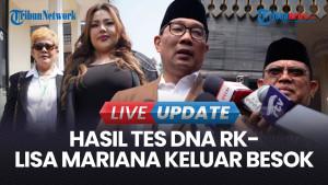 Polri Pastikan Hasil Tes DNA Ridwan Kamil-Lisa Mariana Bakal Keluar Besok