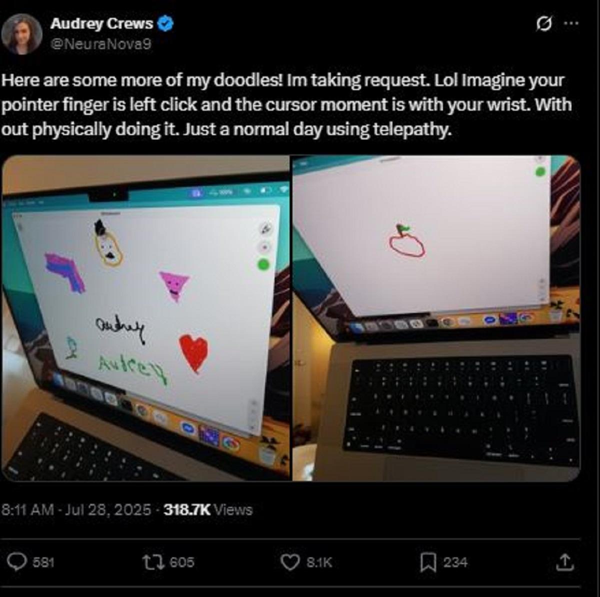 MENULIS DENGAN OTAK. Gambar tangkap layar X/NeuraNova9, Jumat (1/8/2025). Audrey Crews, seorang wanita asal Louisiana, Amerika Serikat, mencetak sejarah sebagai perempuan pertama di dunia yang menerima implan chip otak dari Neuralink.