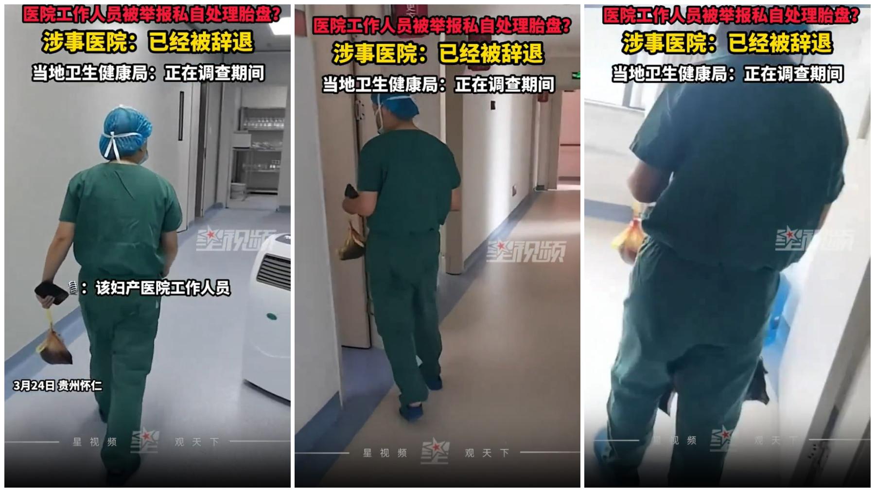 DOKTER CURI PLASENTA - Tangkap layar video dari platform media sosial Xing Shipin, memperlihatkan aksi dokter yang mengambil plasenta ibu yang baru saja melahirkan. Dokter tersebut kini telah dipecat.