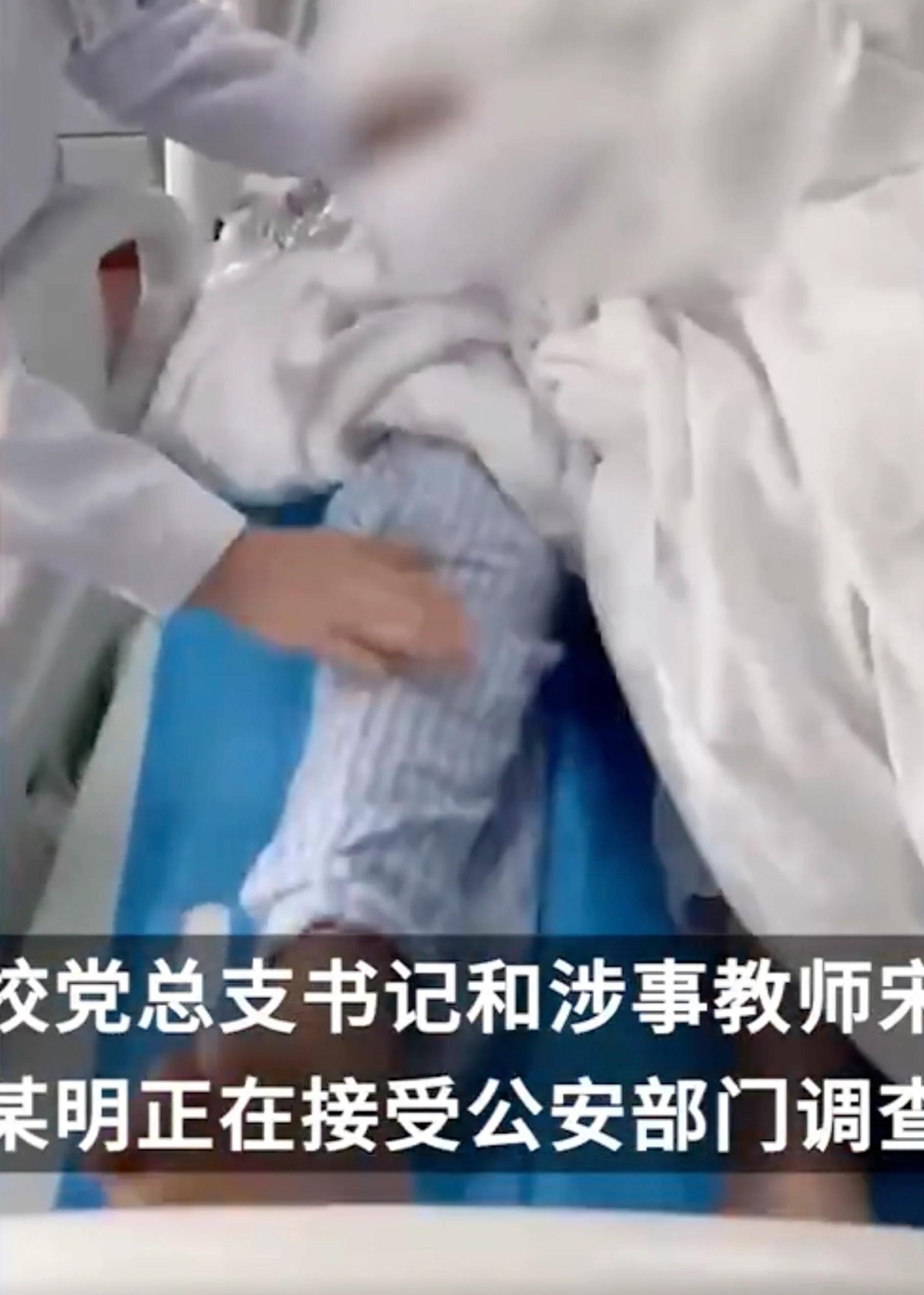 Siswi SD di China menerima perawatan setelah tulang tengkoraknya retak