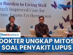 Dokter Ungkap 3 Mitos Besar tentang Lupus: Obat Bukan Penyebab Kerusakan Ginjal