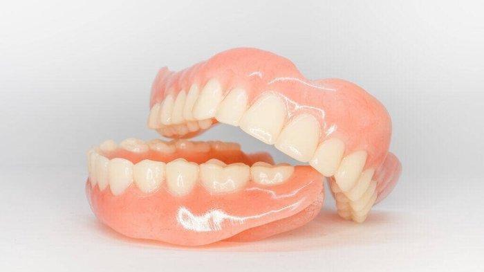 Cara Klaim Gigi Palsu Pakai BPJS Kesehatan, Lengkap dengan Syarat yang Diperlukan