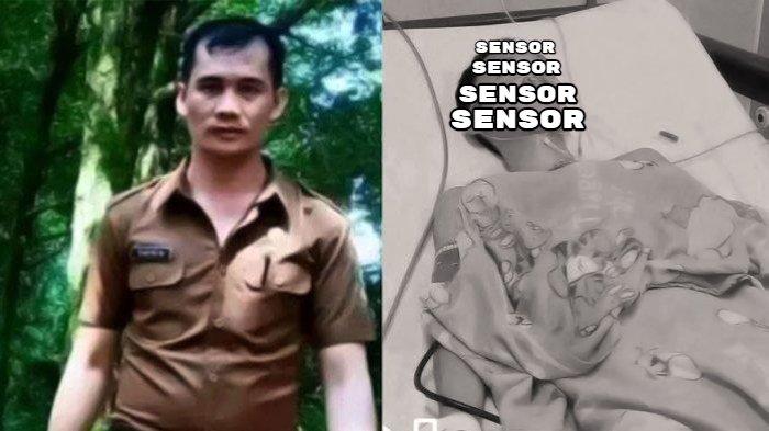 Inilah Safrin Zebua, Kepala Sekolah yang Pukul Kepala Siswa Sampai Saraf Putus hingga Akhirnya.
Seorang siswa SMK di Nias berinisial YN (17) tewas usai diduga dianiaya oleh Kepala Sekolah SMK 1 Siduoari, SZ (37). YN mengaku sempat dipukul di bagian kening sebanyak lima kali oleh SZ. ((Tribun Medan/Arjuna Bakkara))