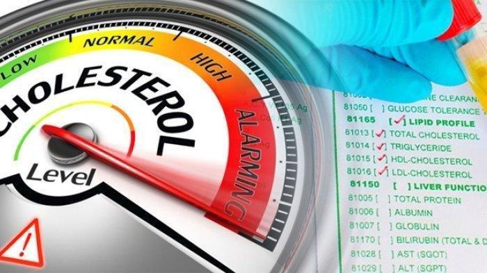 Segini Biaya Cek Kolesterol di Puskesmas Gratis Pakai BPJS Kesehatan