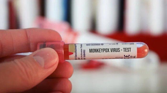 Roche mengklaim berhasil menemukan alat tes Polymerase Chain Reaction (PCR) yang dapat mendeteksi penyakit cacar monyet (Monkeypox), saat virus itu menyebar ke luar dari negara endemik.
