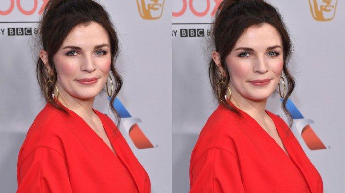 aisling bea plastic surgery Image 3