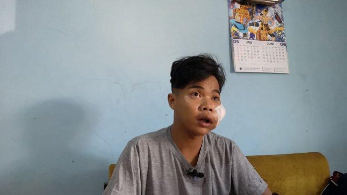 Wajah korban begal jalanan di Kecamatan Grogol