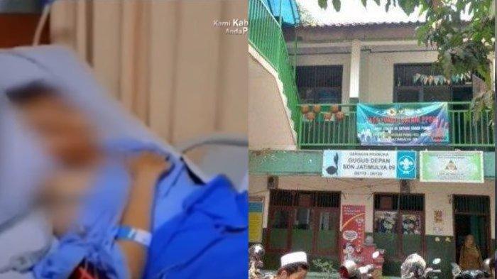 Siswa SMP FAA (12) menjalani operasi amputasi karena menderita kanker tulang akibat disengkat oleh teman-temannya saat masih di SDN Jatimulya 09 Tambun