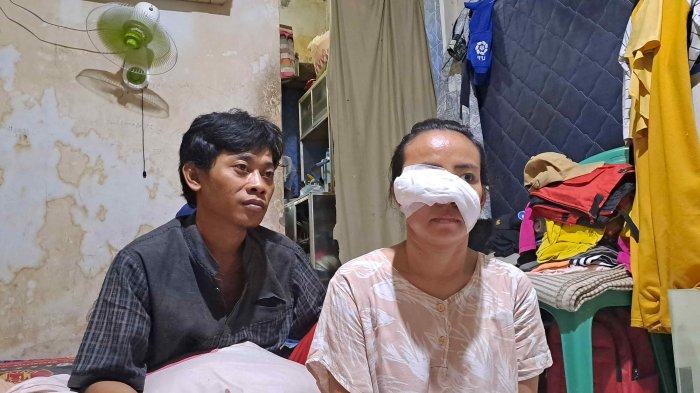 Rindu Utami (26) wanita cantik yang disayat cutter oleh mantan pacar suami di wajahnya mendapat 28 jahitan dan akan cacat permanen.