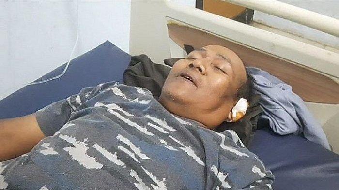 Sadira, sopir bus Putera Fajar, yang membawa rombongan pelajar SMK Lingga Kencana, Kota Depok, mengalami luka ringan saat kecelakaan maut di Subang, Jawa Barat, Sabtu (11/5/2024) petang.
