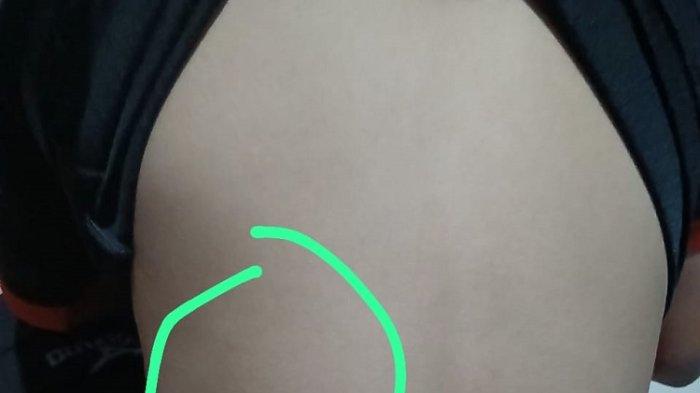 Anak SD di Kota Bekasi Diduga Jadi Korban Kekerasan, KPAD Turun Tangan