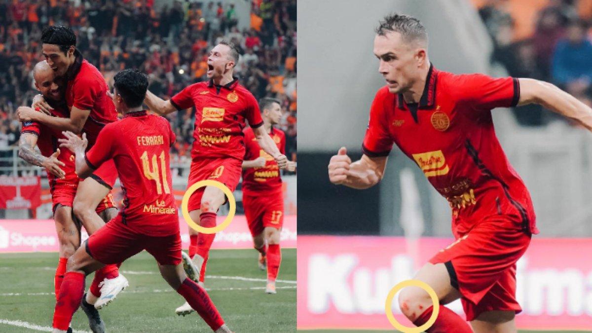 lutut Macieg Gajos yang berdarah